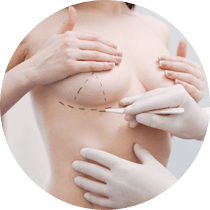 Breast-Surgery Breast Surgery
