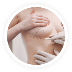 shadow-image1 Breast Surgery